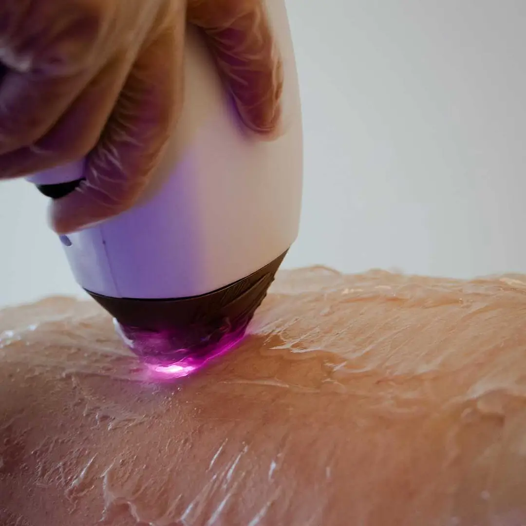 Sfaturi suplimentare pentru epilare definitiva sprancene